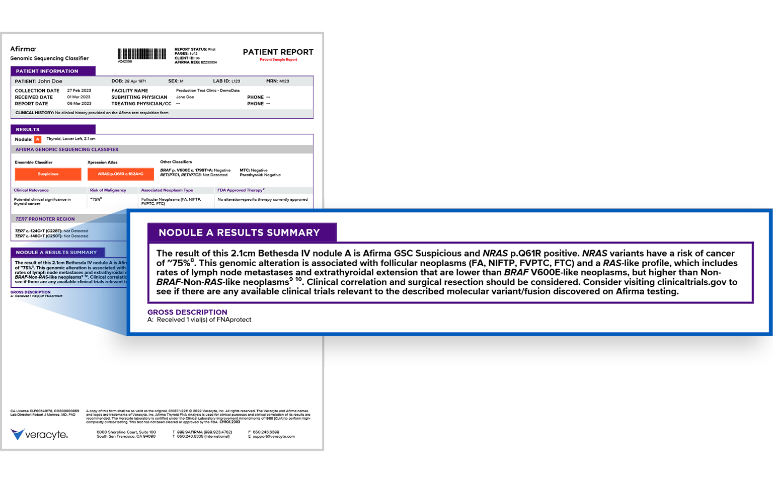 afirma patient report nodule A results summary